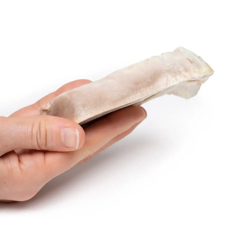 3D Printed Uterine Leiomyoma